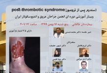 وبینـار سندرم پس از ترومبوز